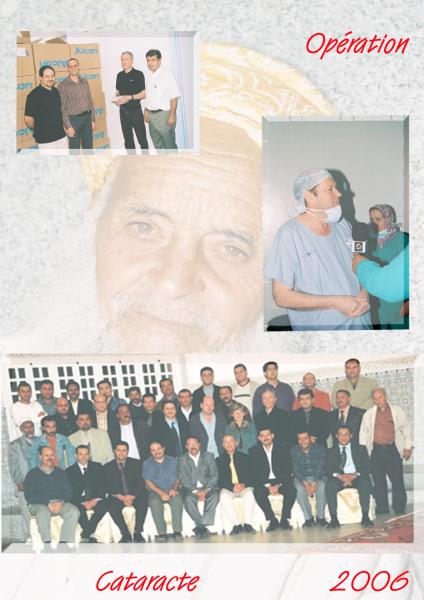 Opration cataracte 2